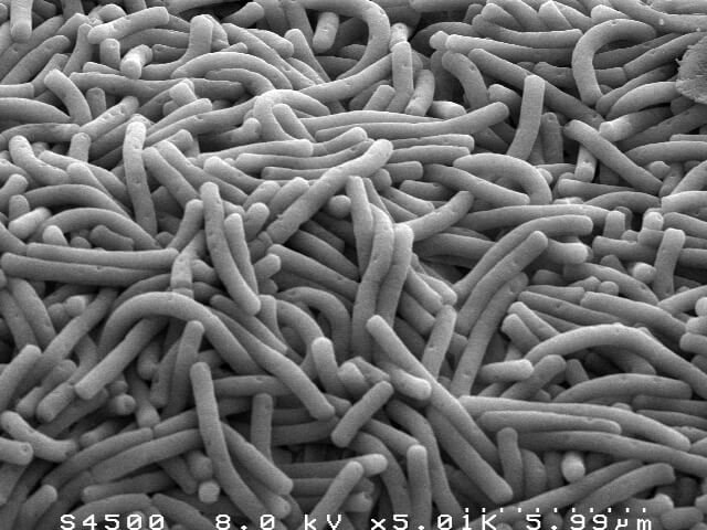 Lactobacillus bulgaricus-- Yogurt bacteria